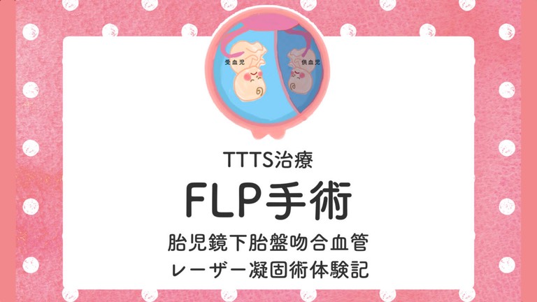 FLP　手術　TTTS 双胎官輸血症候群　体験談　経験